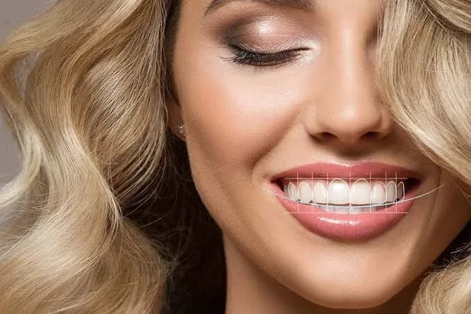 Digital Smile Design — Dr. Mukesh Dental, Kothrud Pune