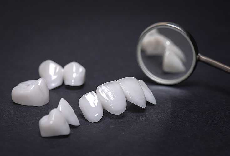 Porcelain dental crowns and bridge restorations beside a dental mirror